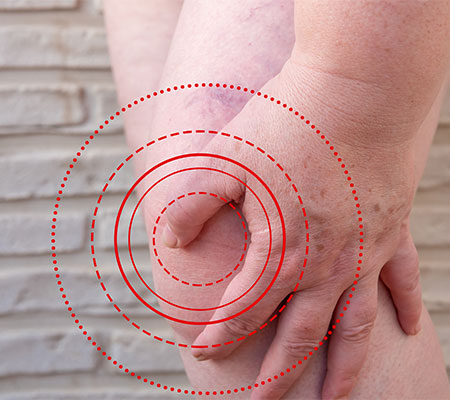 Diagnosing and treating Osteoporosis