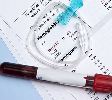 The need to identify haemoglobinopathies when using HbA1c as a diagnostic test